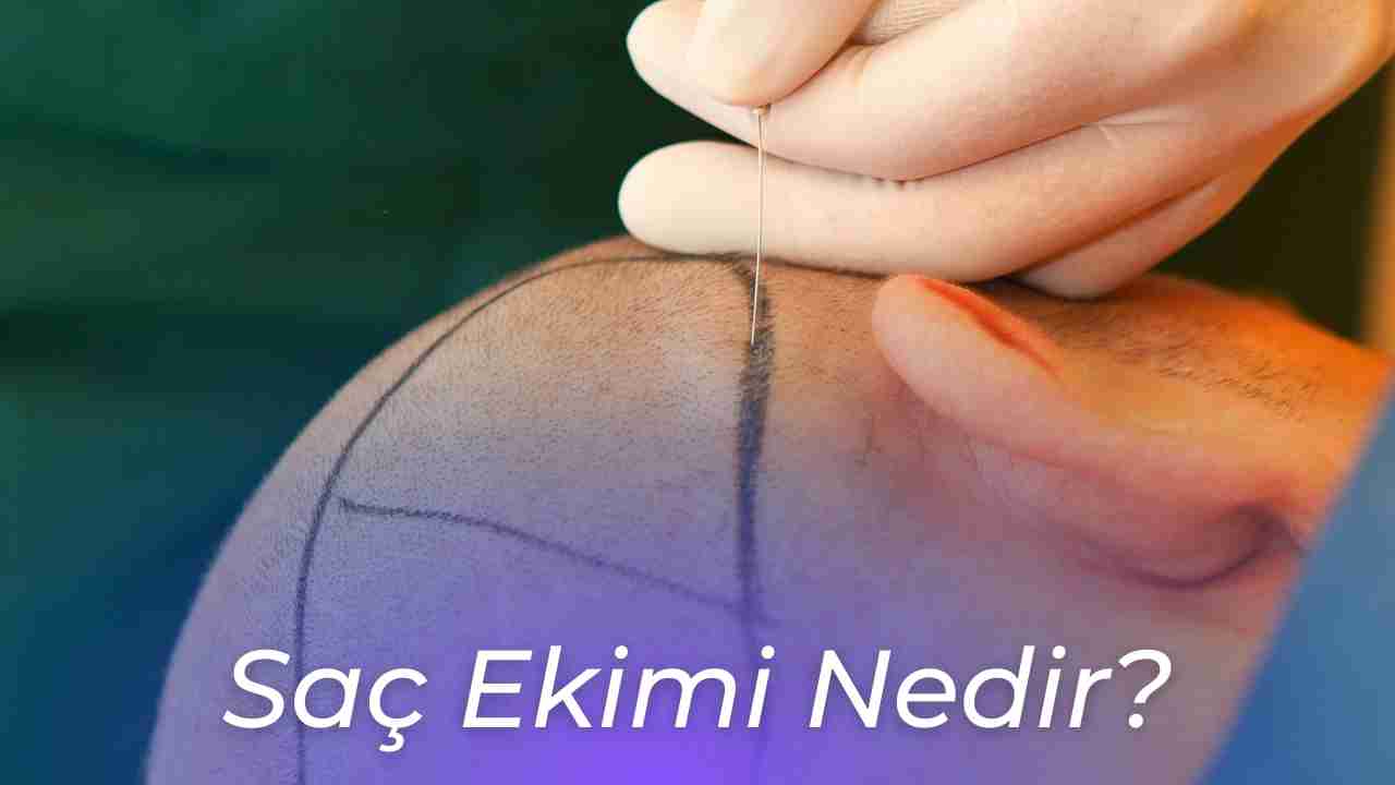 Saç Ekimi Nedir 2023 Sağlık Siteniz