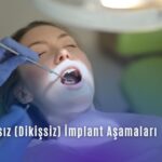Ameliyatsız ve Acısız İmplant Nedir? En iyi nasıl yapılır? Avantajları ve Ömrü 3 İmplant tedavisi Antalya klinik