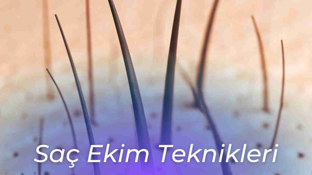 Saç Ekimi Nedir 2 saç ekimi yöntemleri nelerdir? fue nedir? fut nedir? saç ekimi teknikleri